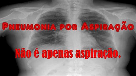 pneumonia por aspiração